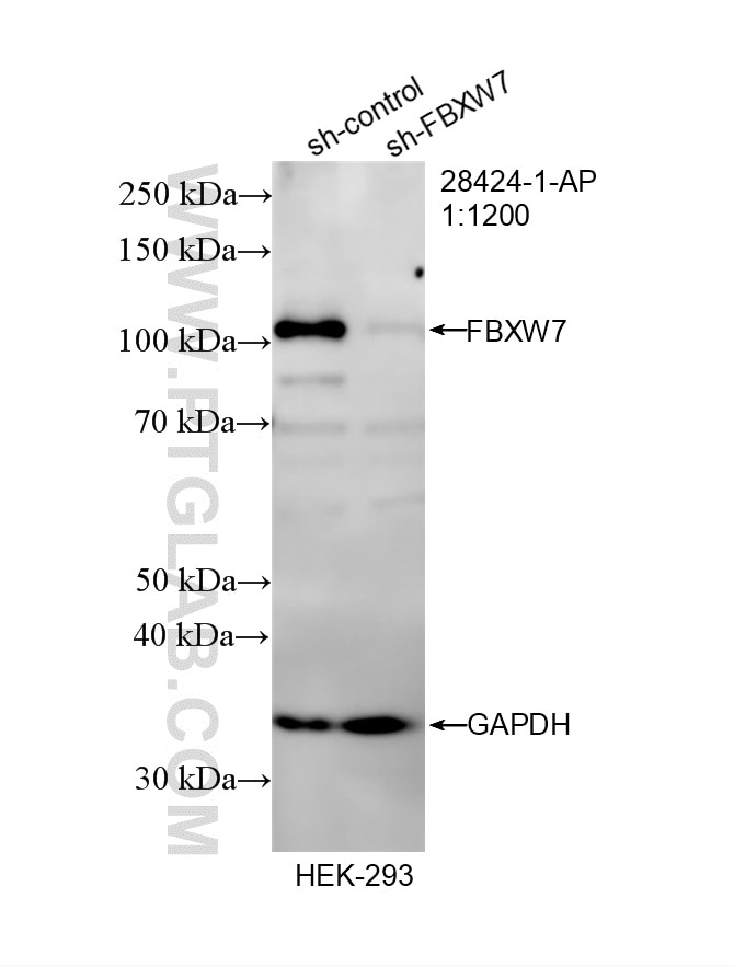 Western Blot (WB) analysis of HEK-293 cells using FBXW7 Polyclonal antibody (28424-1-AP)