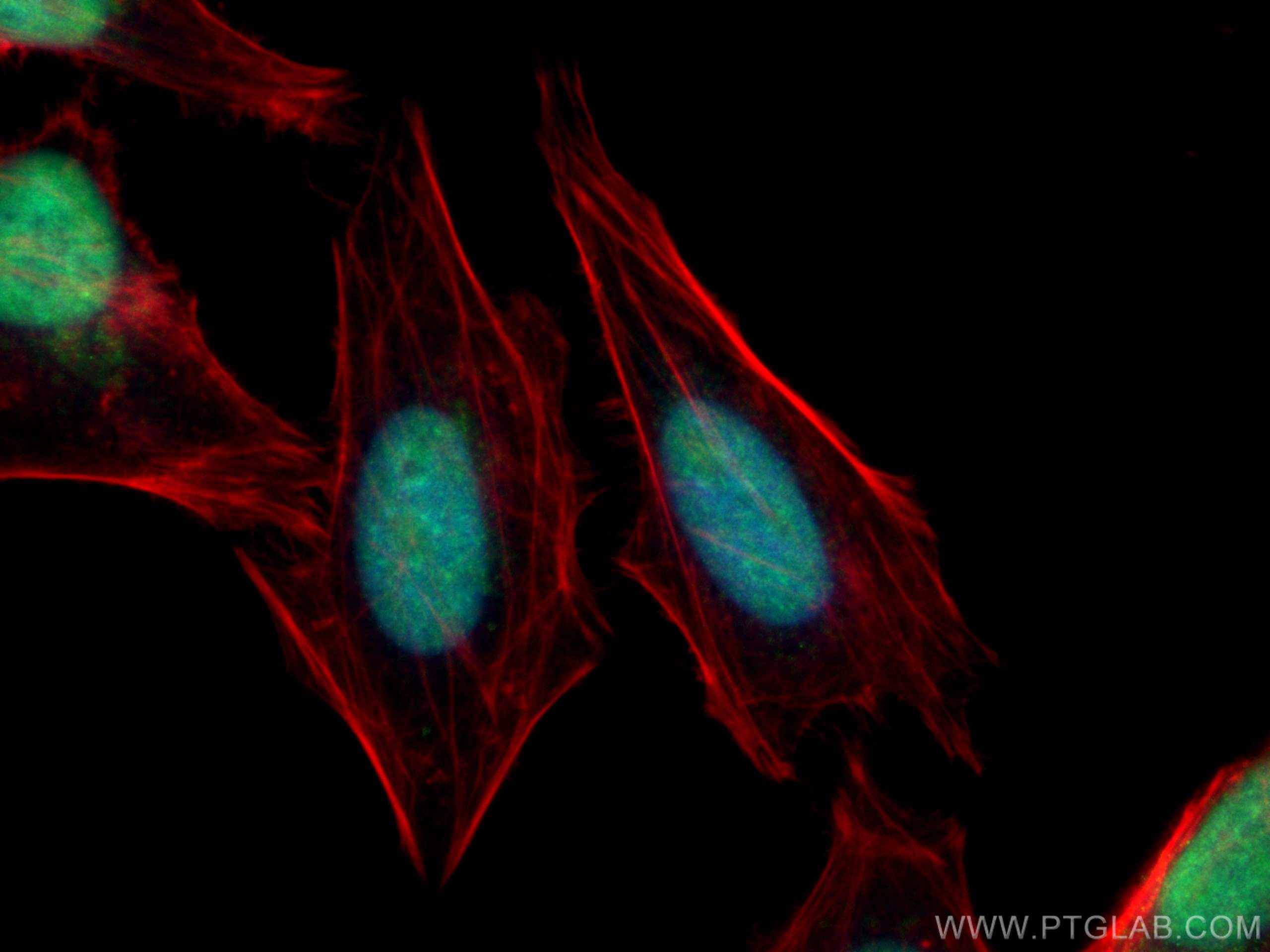 Immunofluorescence (IF) / fluorescent staining of HeLa cells using FBXW7 Polyclonal antibody (55290-1-AP)
