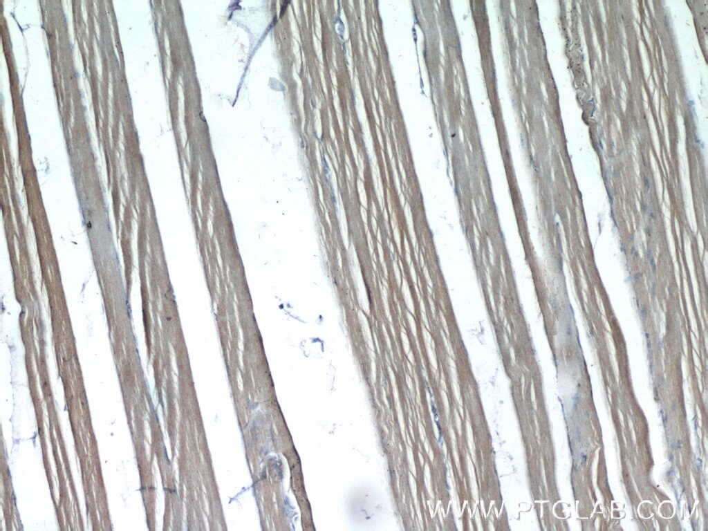 Immunohistochemistry (IHC) staining of human skeletal muscle tissue using FBXW7 Polyclonal antibody (55290-1-AP)