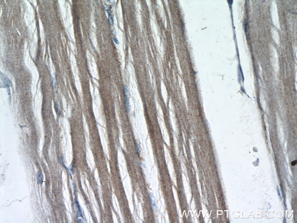 Immunohistochemistry (IHC) staining of human skeletal muscle tissue using FBXW7 Polyclonal antibody (55290-1-AP)