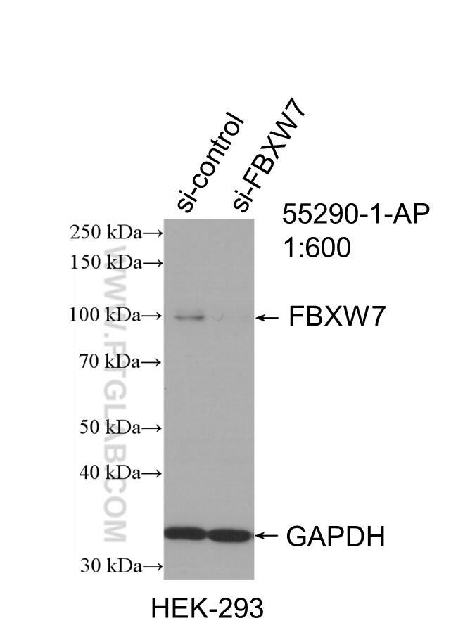 Western Blot (WB) analysis of HEK-293 cells using FBXW7 Polyclonal antibody (55290-1-AP)