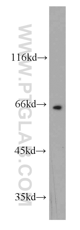 Western Blot (WB) analysis of human brain tissue using FBXW7 Polyclonal antibody (55290-1-AP)