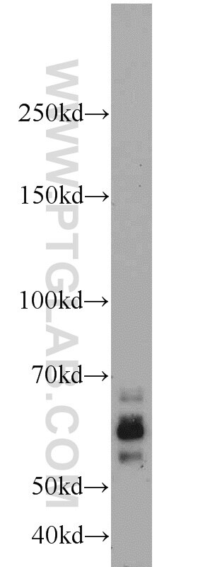 FBXW7 Polyclonal antibody