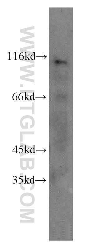 Western Blot (WB) analysis of HEK-293 cells using FBXW7 Polyclonal antibody (55290-1-AP)