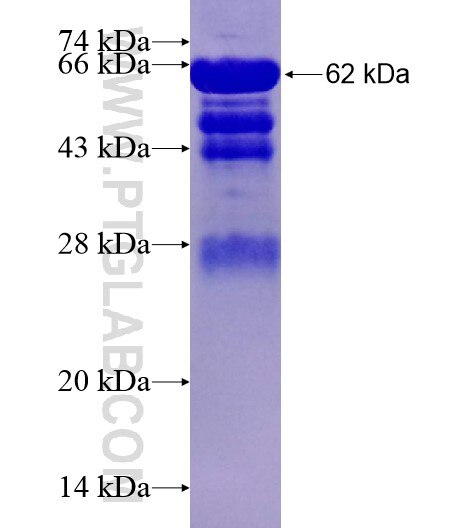 FBXW7 fusion protein Ag28460 SDS-PAGE FBXW7 fusion protein Ag28460 SDS-PAGE