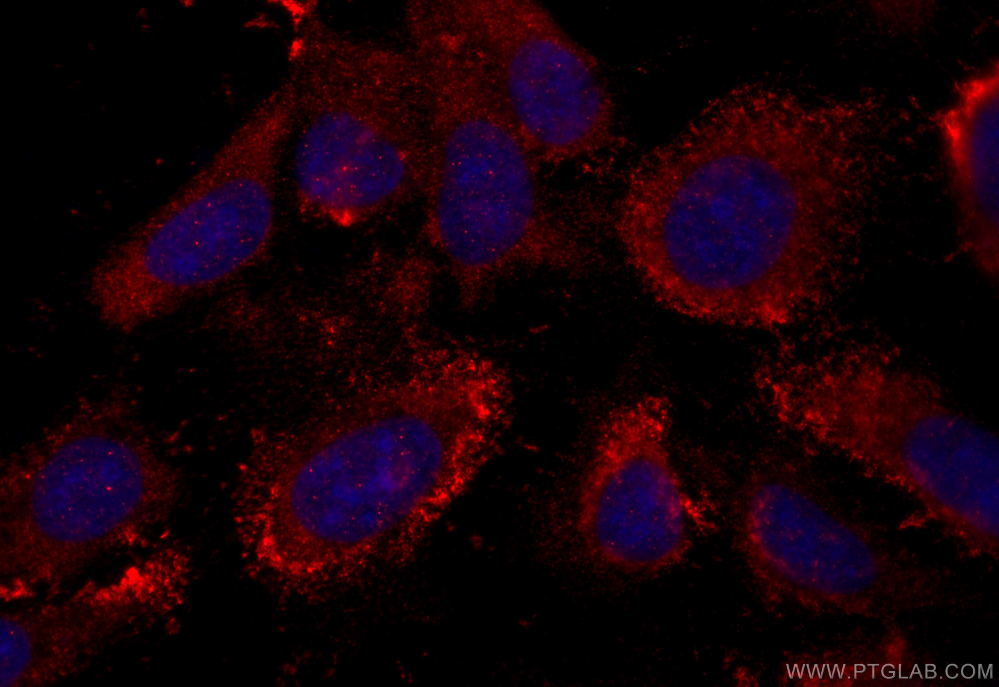 Immunofluorescence (IF) / fluorescent staining of U2OS cells using FBXW9 Polyclonal antibody (20464-1-AP)