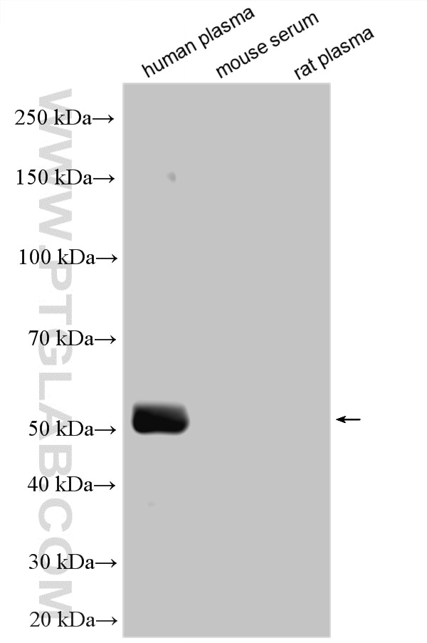 Various lysates were subjected to SDS PAGE followed by western blot with HRP-68275 (FC of Human IgG antibody) at dilution of 1:5000 incubated at room temperature for 1.5 hours. Western Blot (WB) analysis of various lysates using HRP-conjugated FC of Human IgG Monoclonal antibody (HRP-68275)
