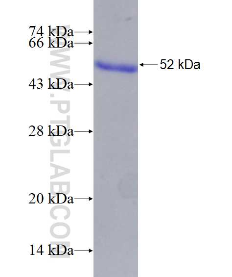 FC tag fusion protein Ag27844 SDS-PAGE