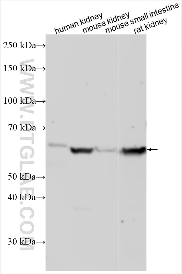 Western Blot (WB) analysis of various lysates using FCAMR Polyclonal antibody (31929-1-AP)