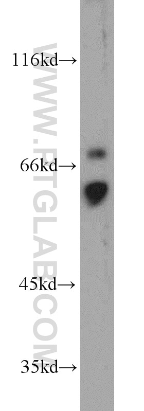 Western Blot (WB) analysis of HL-60 cells using CD89 Polyclonal antibody (13245-1-AP)