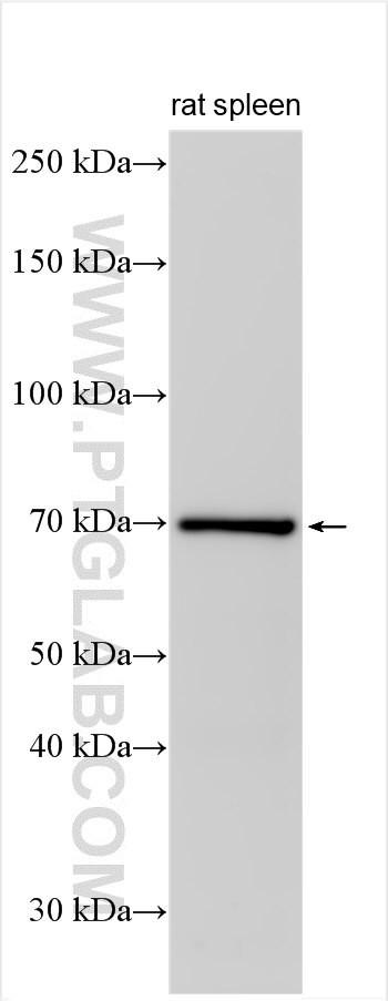 Western Blot (WB) analysis of rat spleen tissue using Fc Epsilon RI Alpha Polyclonal antibody (10980-1-AP)