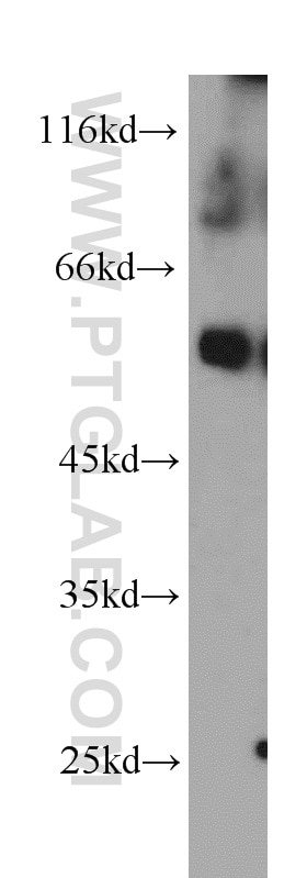 Western Blot (WB) analysis of PC-3 cells using Fc Epsilon RI Alpha Polyclonal antibody (10980-1-AP)