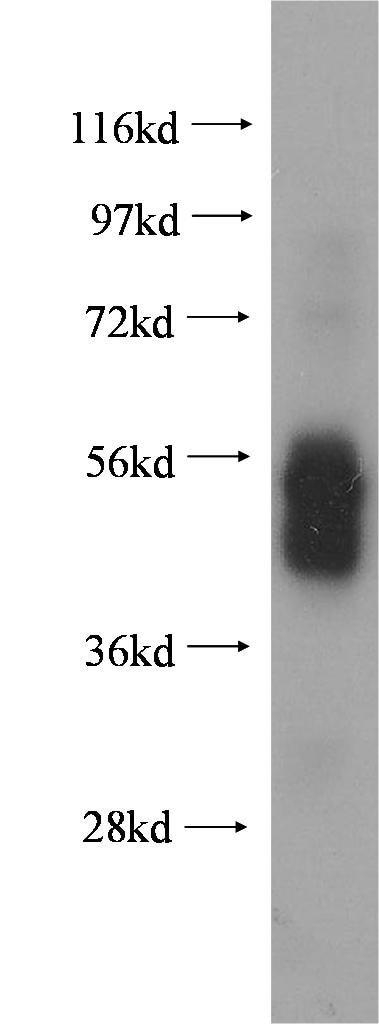 Western Blot (WB) analysis of human spleen tissue using Fc Epsilon RI Alpha Polyclonal antibody (10980-1-AP)