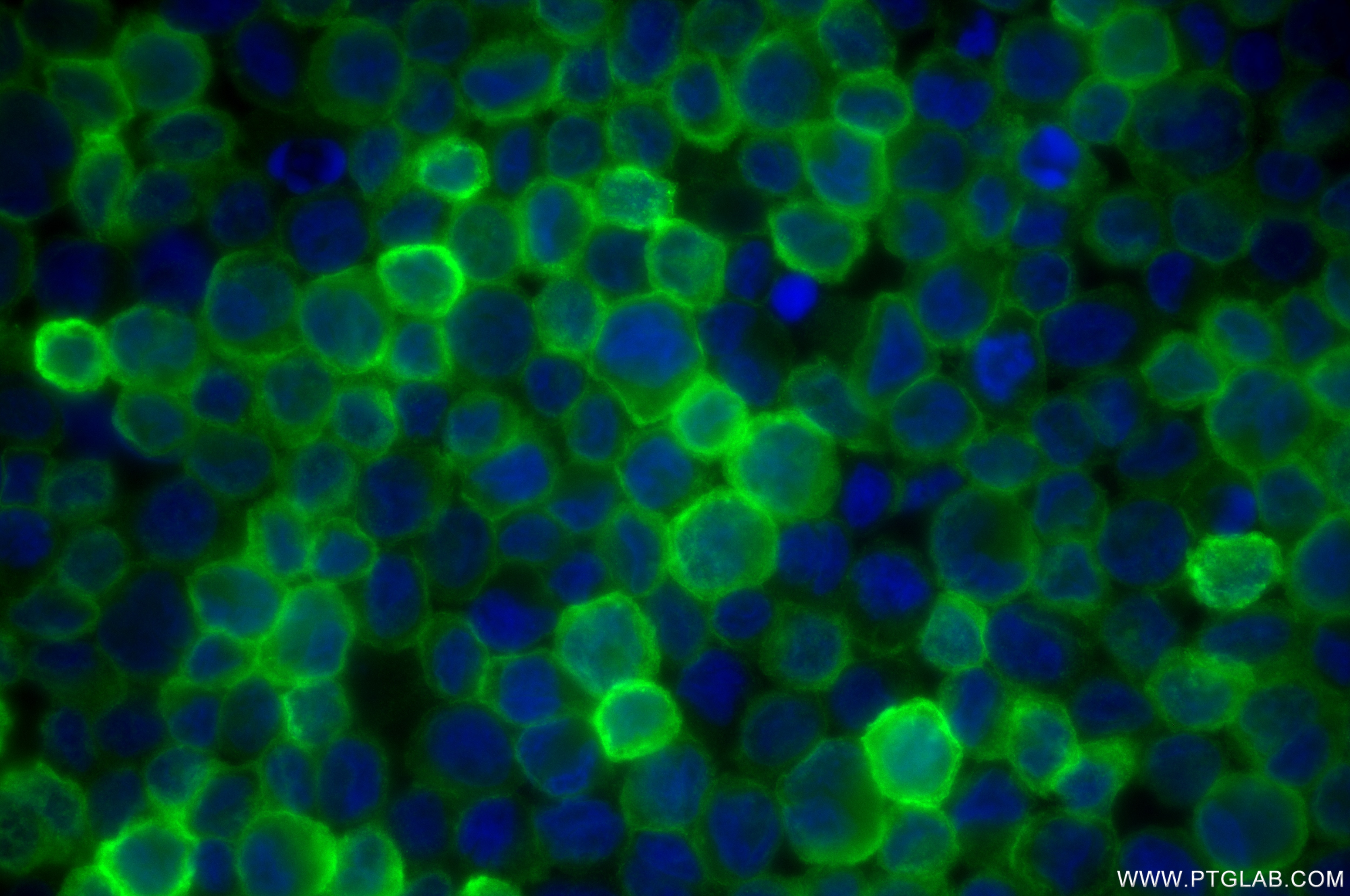 Immunofluorescence (IF) / fluorescent staining of THP-1 cells using FCER1G Recombinant antibody (85390-1-RR)