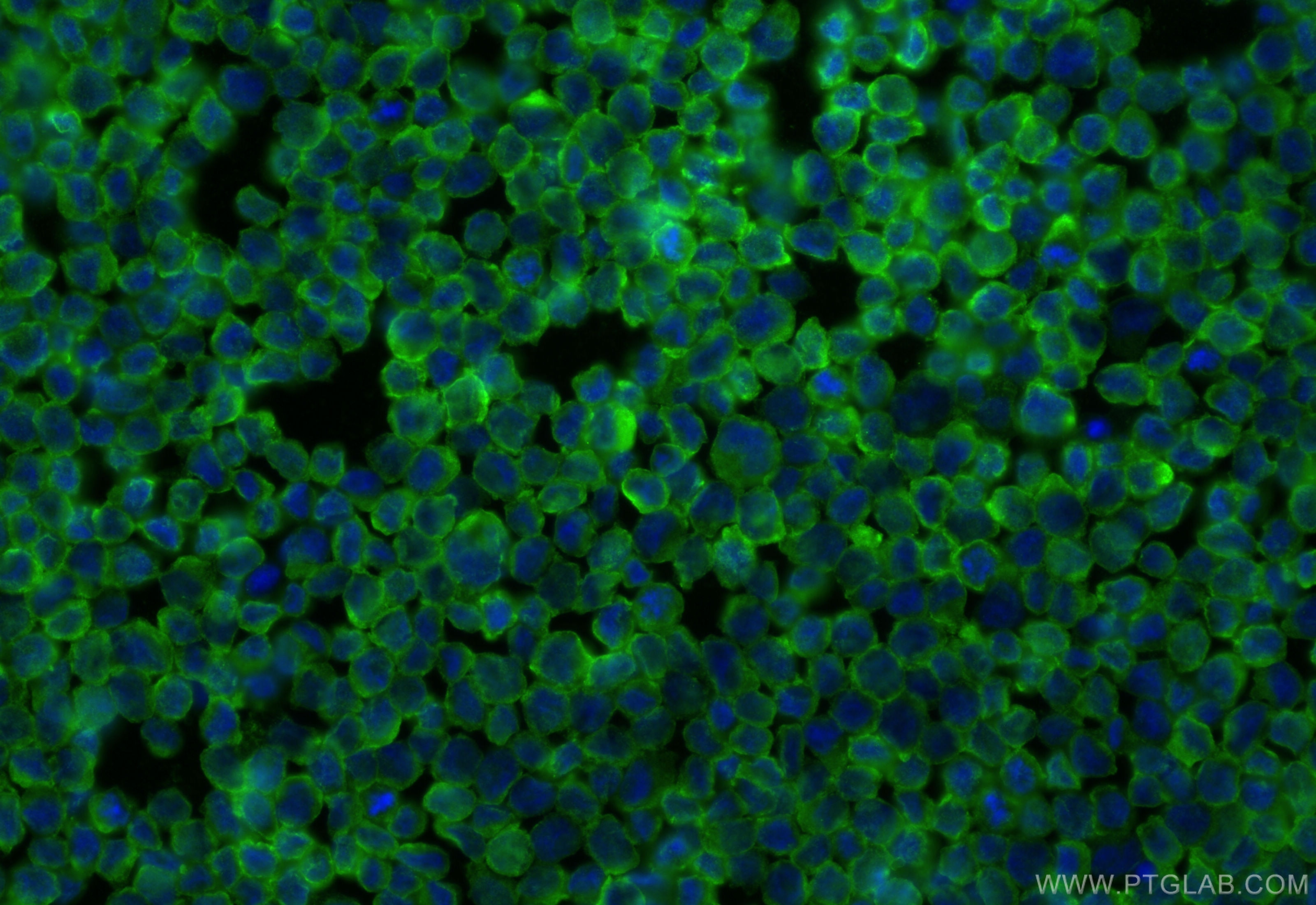 Immunofluorescence (IF) / fluorescent staining of THP-1 cells using CD64 Polyclonal antibody (27563-1-AP)