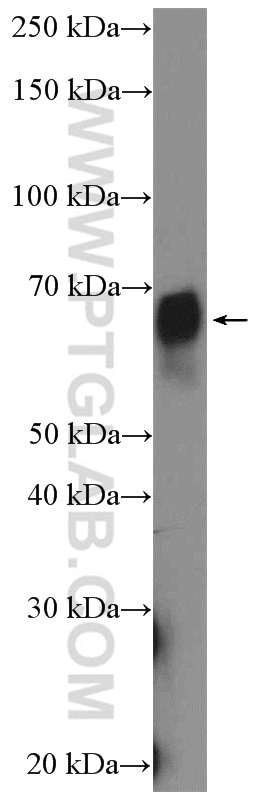 Western Blot (WB) analysis of U-937 cells using CD64 Polyclonal antibody (27563-1-AP)