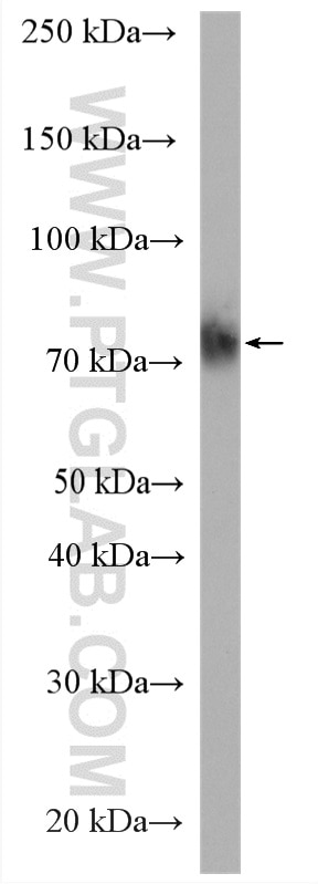 Western Blot (WB) analysis of HL-60 cells using CD64 Polyclonal antibody (27563-1-AP)