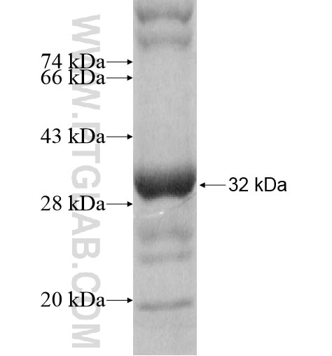 FCGR1A fusion protein Ag11939 SDS-PAGE