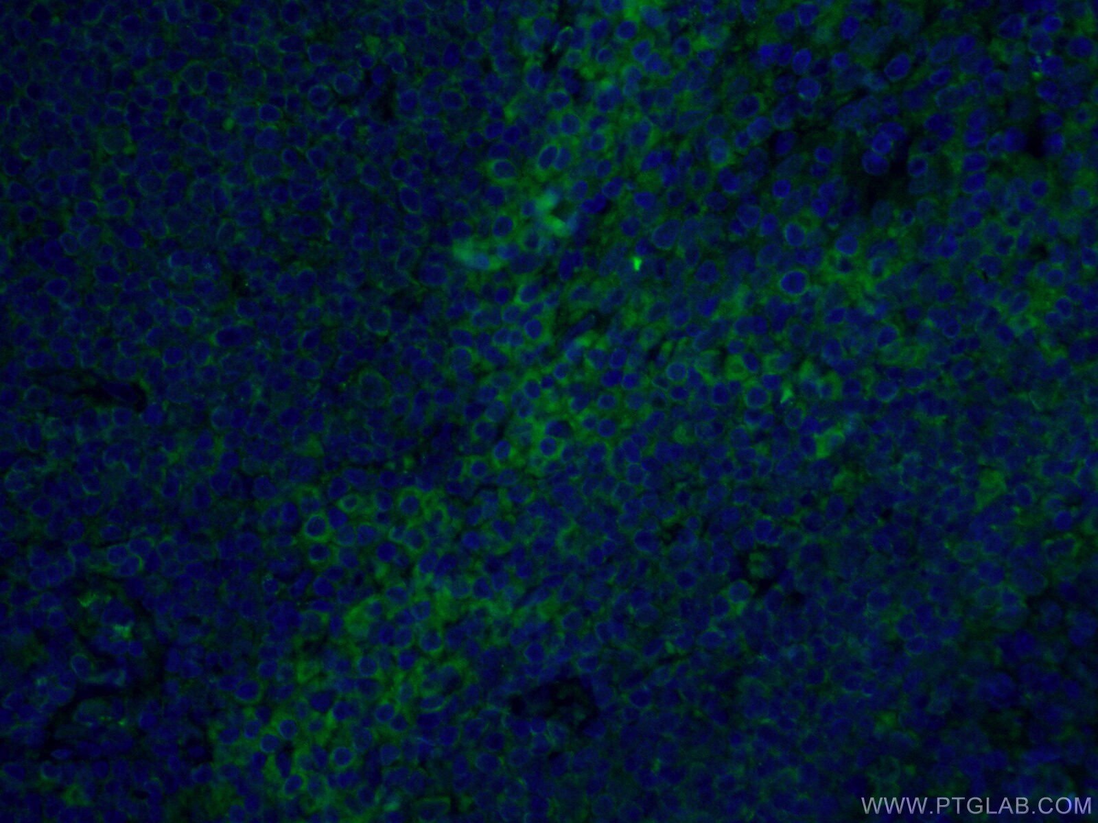 Immunofluorescence (IF) / fluorescent staining of human tonsillitis tissue using CoraLite® Plus 488-conjugated FCGR2A / CD32a Monoc (CL488-66529)
