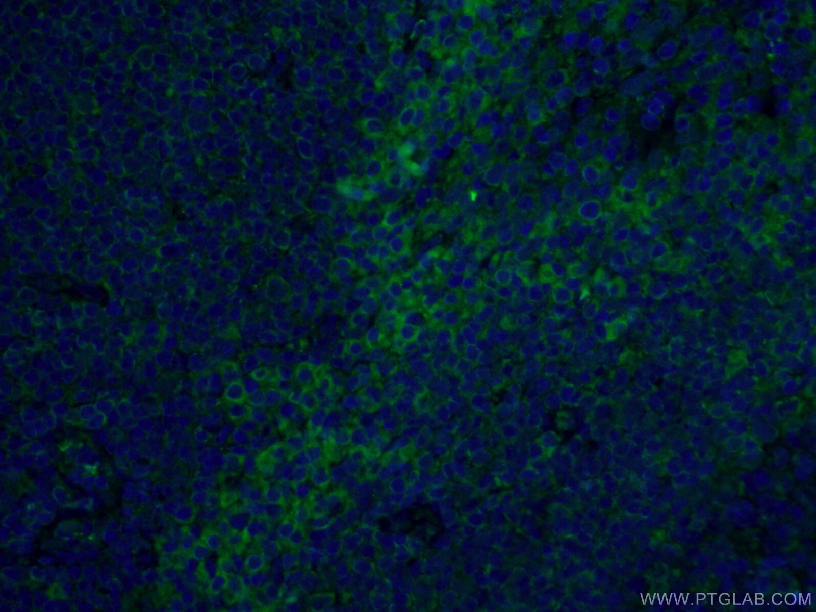 IF Staining of human tonsillitis using CL488-66529