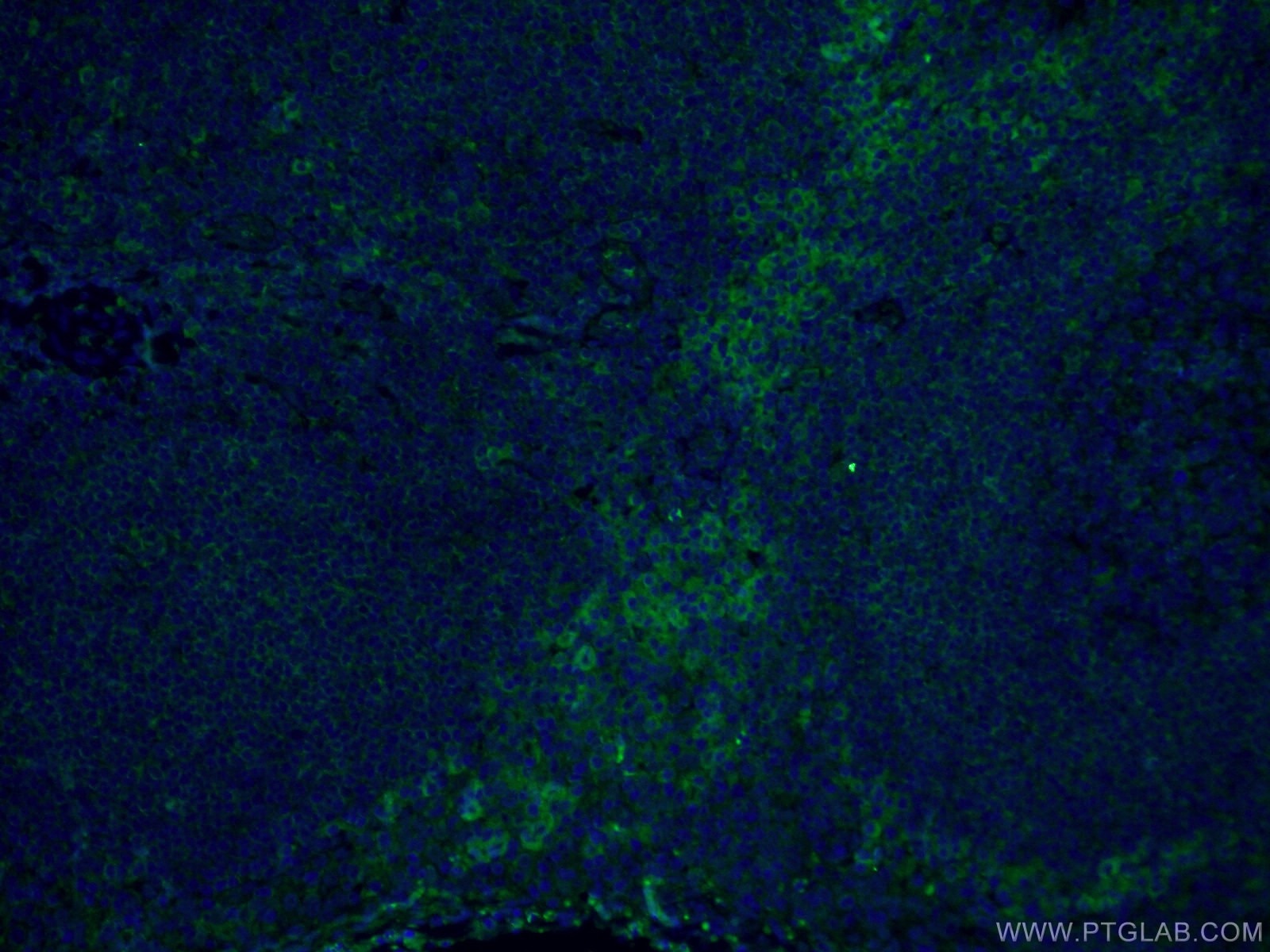 Immunofluorescence (IF) / fluorescent staining of human tonsillitis tissue using CoraLite® Plus 488-conjugated FCGR2A / CD32a Monoc (CL488-66529)