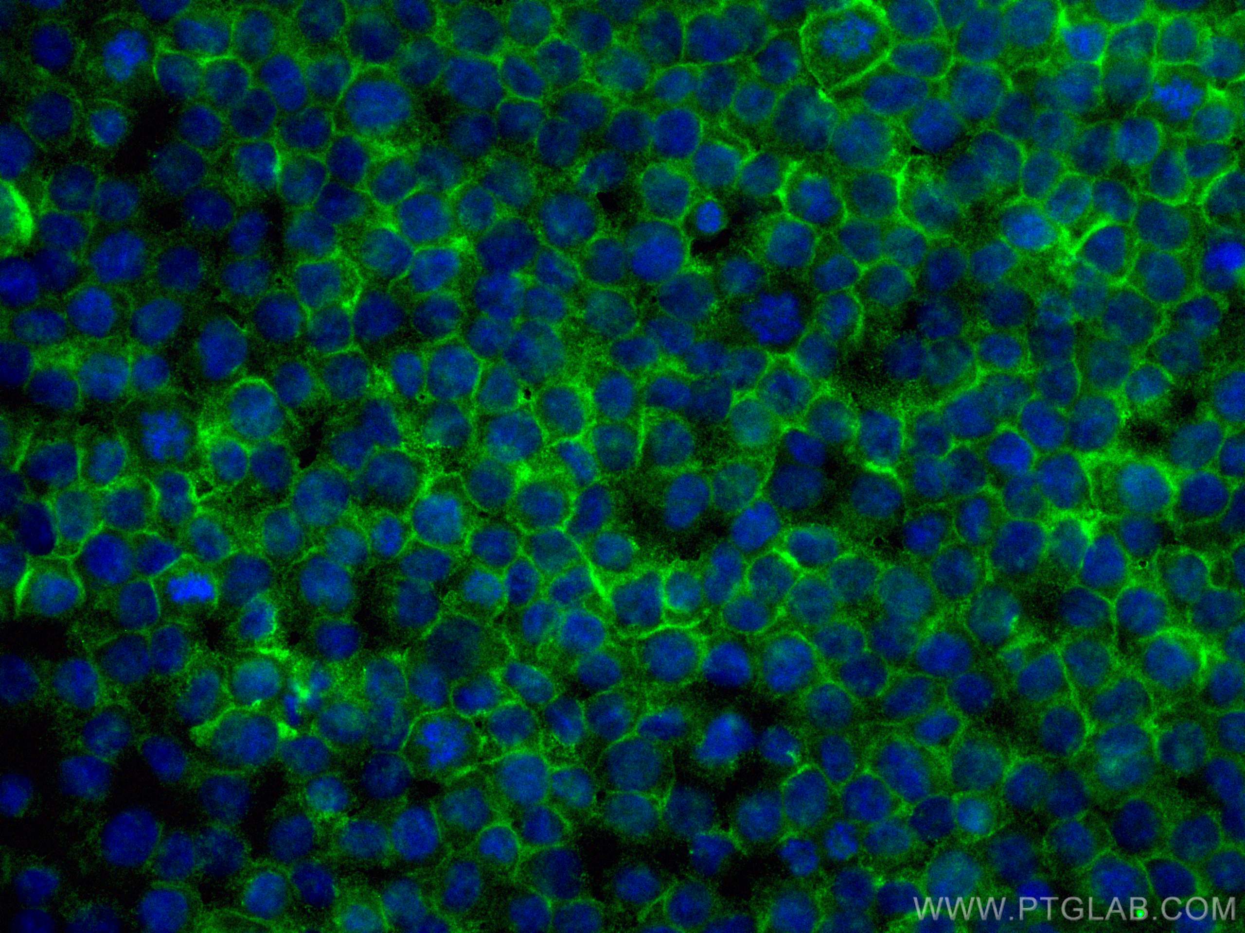 Immunofluorescence (IF) / fluorescent staining of THP-1 cells using CoraLite® Plus 488-conjugated FCGR2A / CD32a Monoc (CL488-66529)