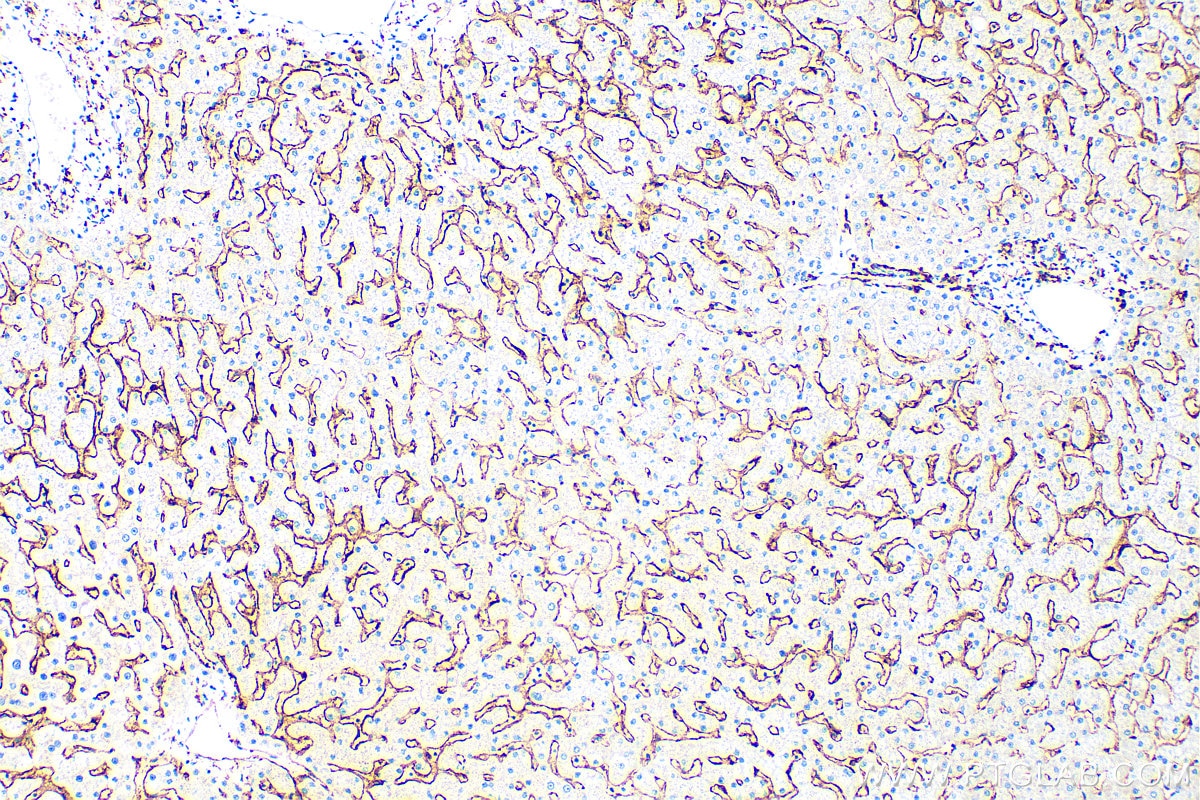 Immunohistochemistry (IHC) staining of human liver tissue using FCGR2A / CD32a Polyclonal antibody (15625-1-AP)