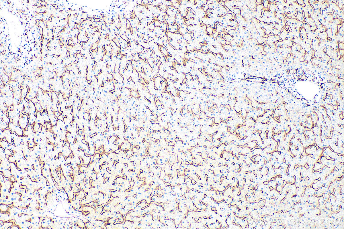 Immunohistochemistry (IHC) staining of human liver tissue using FCGR2A / CD32a Polyclonal antibody (15625-1-AP)