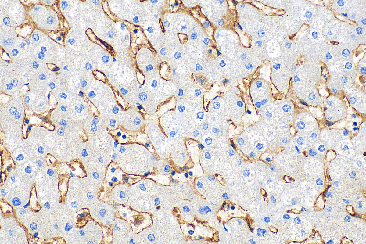 Immunohistochemistry (IHC) staining of human liver tissue using FCGR2A / CD32a Polyclonal antibody (15625-1-AP)