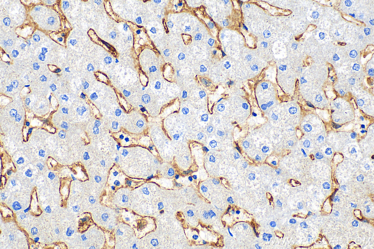 IHC staining of human liver using 15625-1-AP