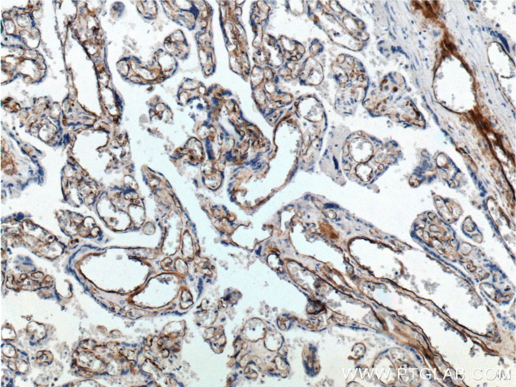 Immunohistochemistry (IHC) staining of human placenta tissue using FCGR2B / CD32b Polyclonal antibody (21541-1-AP)