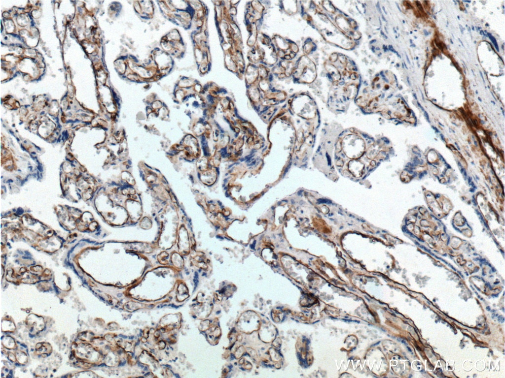 IHC staining of human placenta using 21541-1-AP