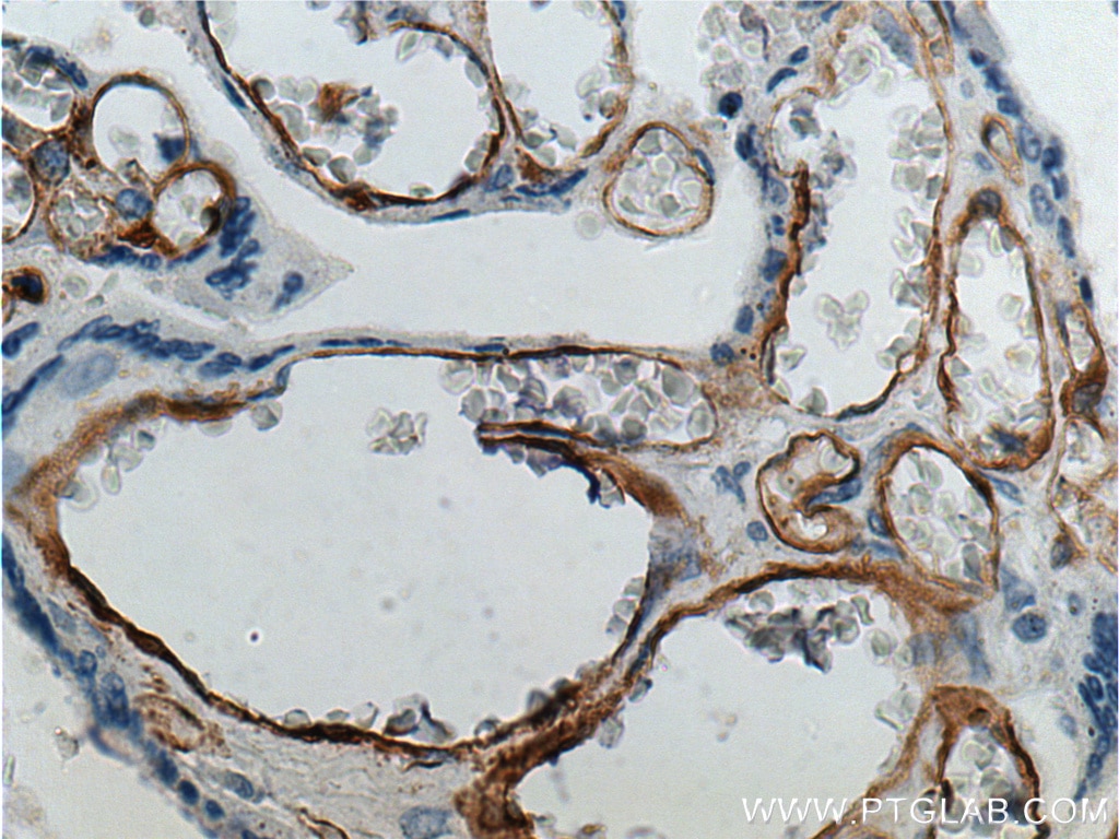 Immunohistochemistry (IHC) staining of human placenta tissue using FCGR2B / CD32b Polyclonal antibody (21541-1-AP)