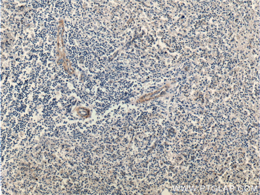 Immunohistochemistry (IHC) staining of human spleen tissue using FCGR2B / CD32b Polyclonal antibody (21541-1-AP)