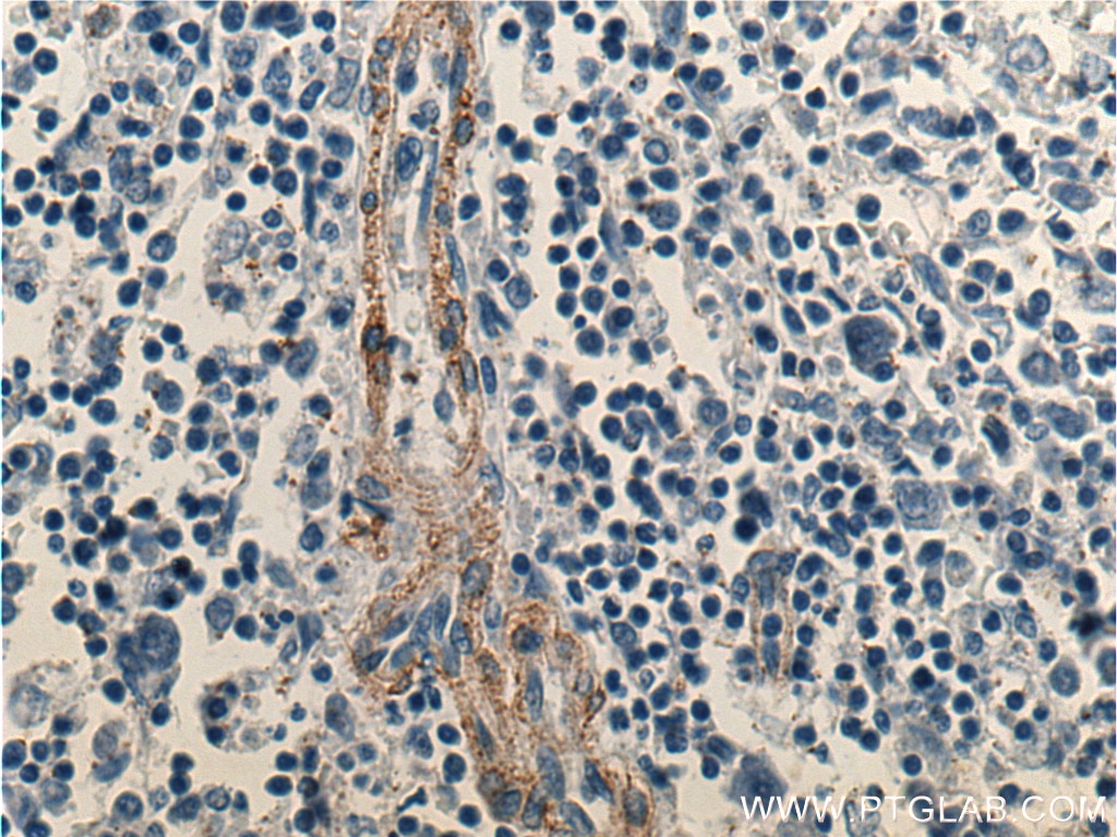 Immunohistochemistry (IHC) staining of human spleen tissue using FCGR2B / CD32b Polyclonal antibody (21541-1-AP)