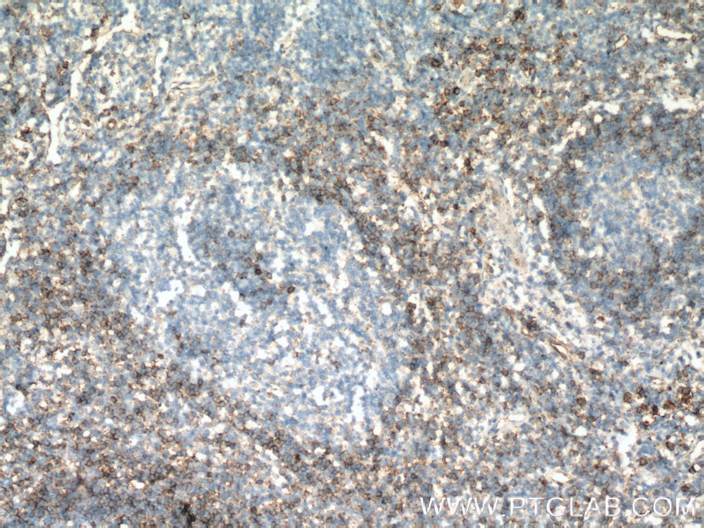 Immunohistochemistry (IHC) staining of human tonsillitis tissue using FCGR2B / CD32b Polyclonal antibody (21541-1-AP)