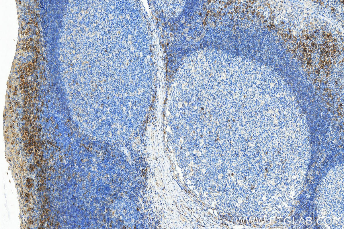 Immunohistochemistry (IHC) staining of human tonsillitis tissue using FCGR2B / CD32b Polyclonal antibody (21541-1-AP)
