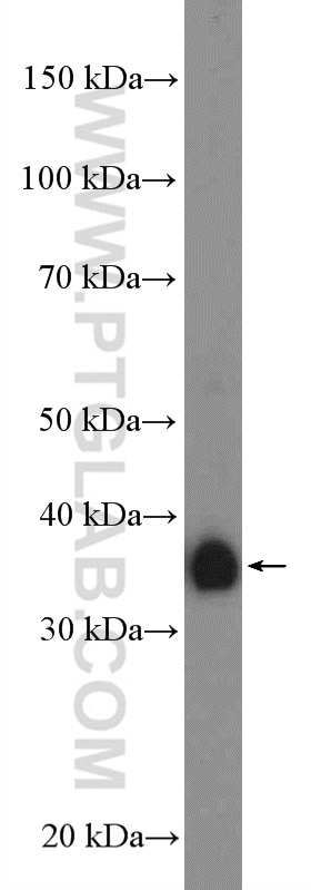 Western Blot (WB) analysis of human placenta tissue using FCGR2B / CD32b Polyclonal antibody (21541-1-AP)