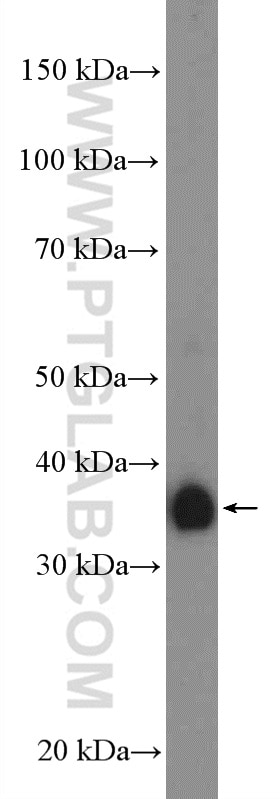 WB analysis of human placenta using 21541-1-AP