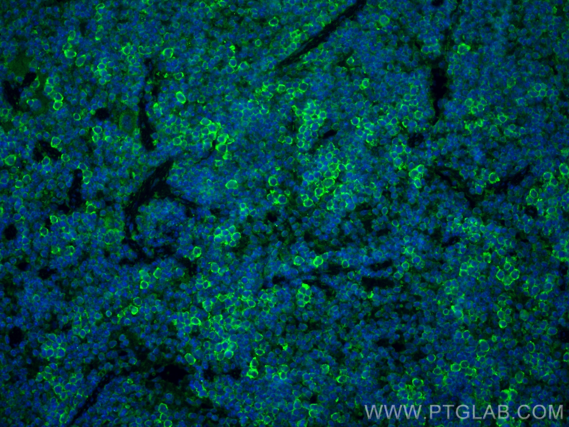 Immunofluorescence (IF) / fluorescent staining of mouse spleen tissue using FCGR3A/CD16a Polyclonal antibody (30356-1-AP)