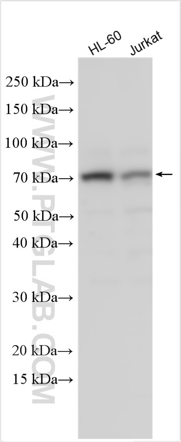 Western Blot (WB) analysis of various lysates using FCGR3A/CD16a Polyclonal antibody (30356-1-AP)