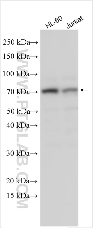 WB analysis using 30356-1-AP