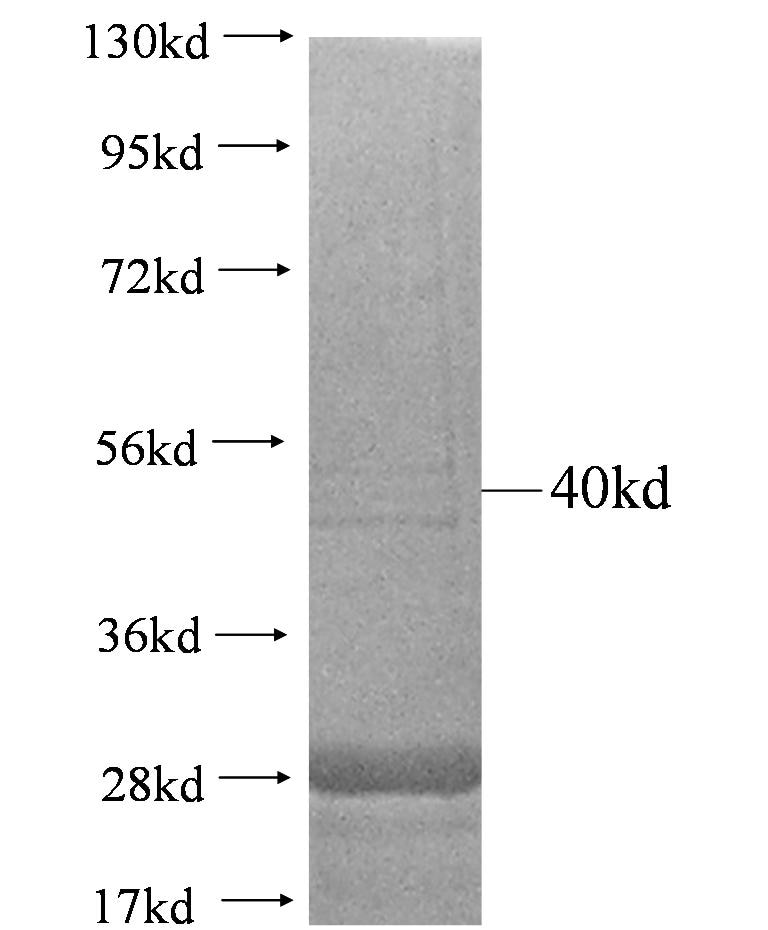 FCGR3A fusion protein Ag1281 SDS-PAGE