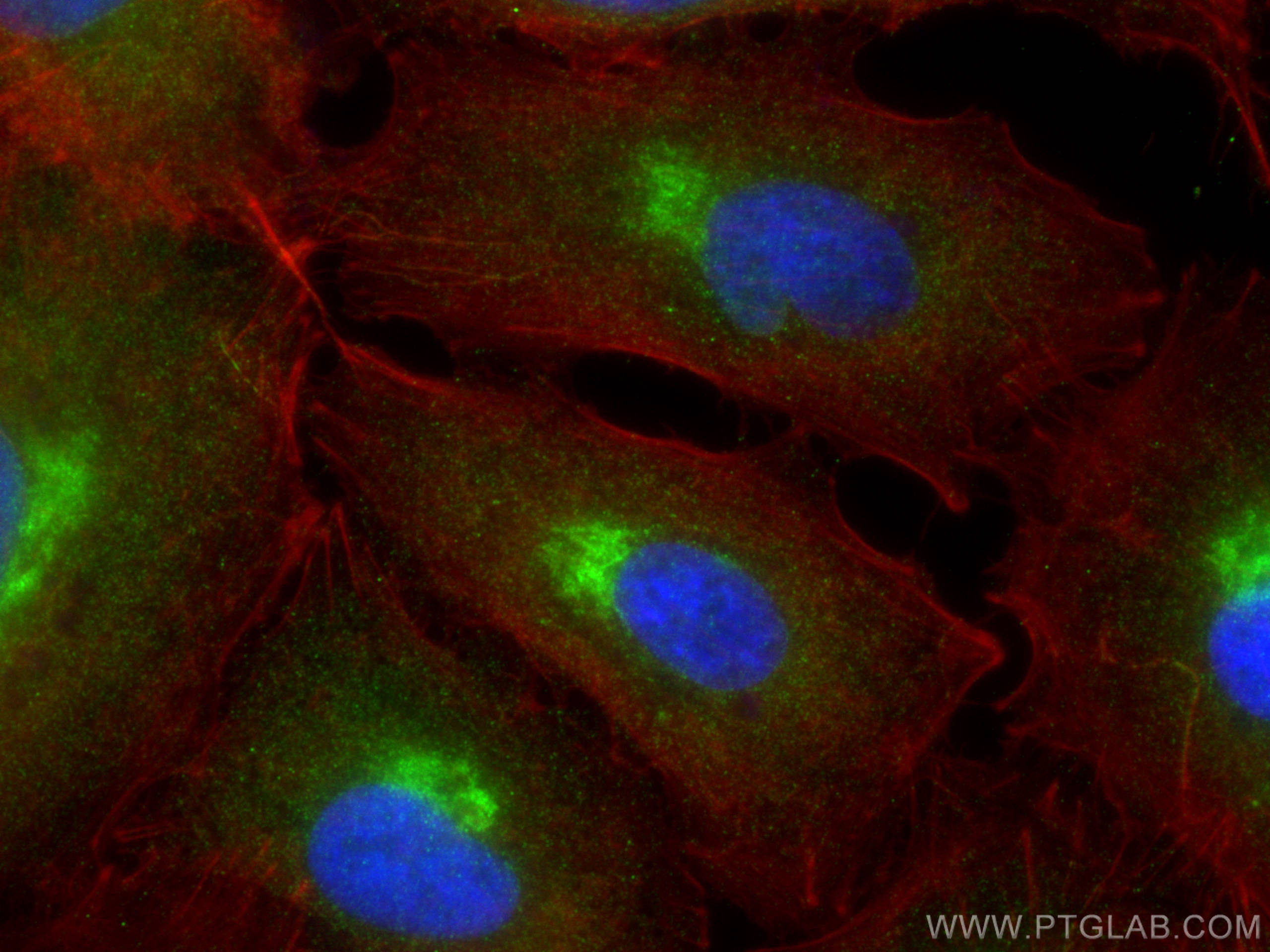 Immunofluorescence (IF) / fluorescent staining of A549 cells using FCGR3B/CD16b Polyclonal antibody (30201-1-AP)