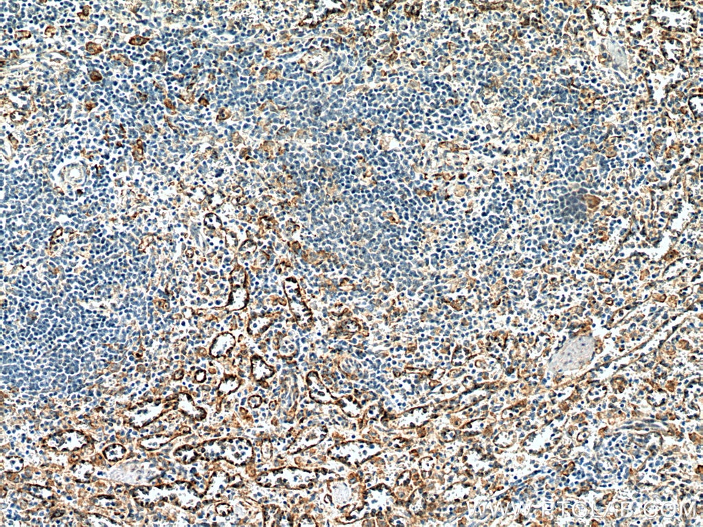 Immunohistochemistry (IHC) staining of human spleen tissue using FcRn-Specific Polyclonal antibody (16190-1-AP)