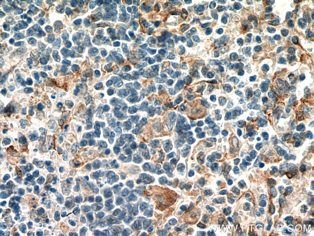 Immunohistochemistry (IHC) staining of human spleen tissue using FcRn-Specific Polyclonal antibody (16190-1-AP)