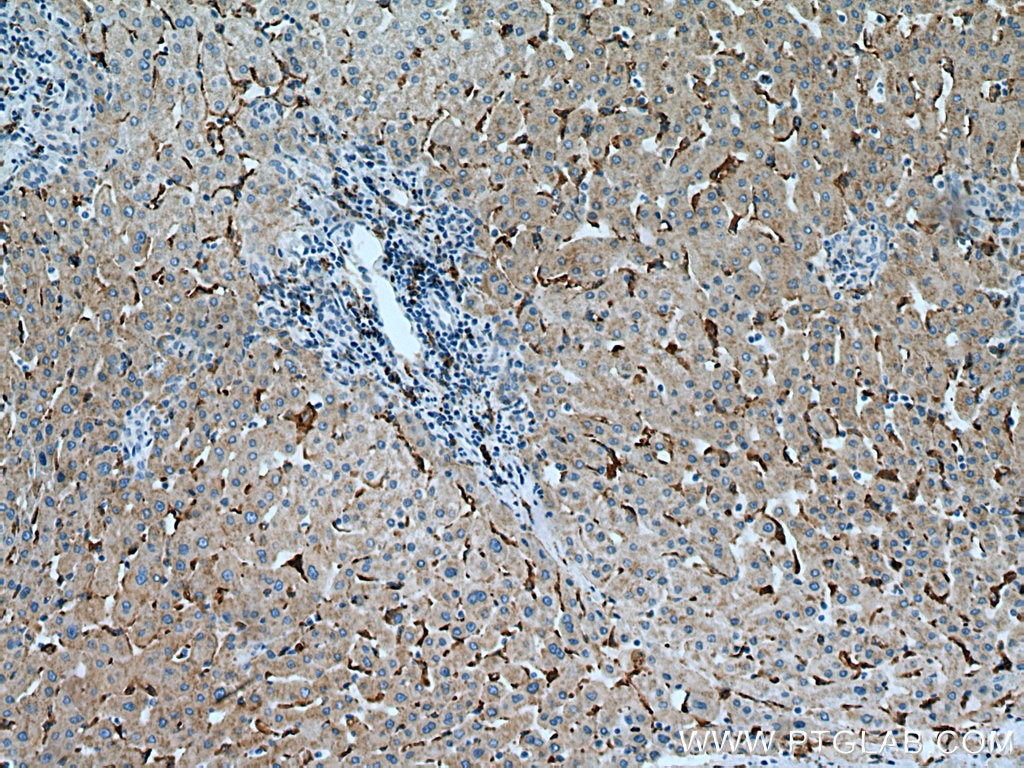 Immunohistochemistry (IHC) staining of human liver tissue using FcRn-Specific Polyclonal antibody (16190-1-AP)