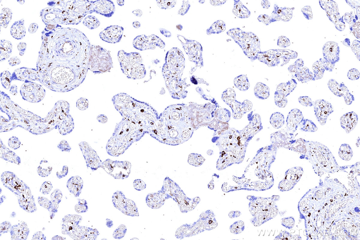 Immunohistochemistry (IHC) staining of human placenta tissue using FcRn-Specific Polyclonal antibody (16190-1-AP)
