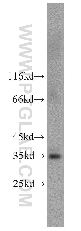 Western Blot (WB) analysis of human placenta tissue using FcRn-Specific Polyclonal antibody (16190-1-AP)