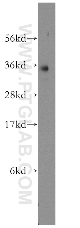 Western Blot (WB) analysis of human liver tissue using FcRn-Specific Polyclonal antibody (16190-1-AP)